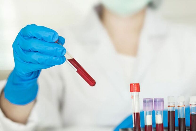 È possibile bere alcolici prima di donare il sangue
